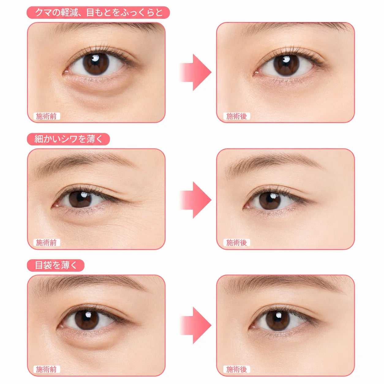 LumiEyes™ 温熱EMSアイケア[在庫限り]